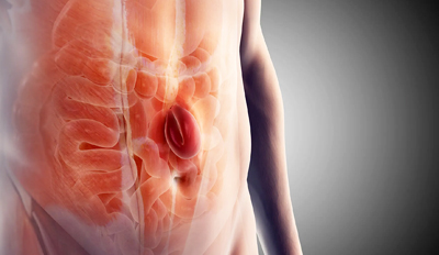 Radiation Therapy Blog