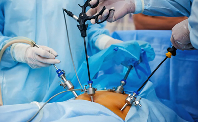 Laparoscopic Surgery